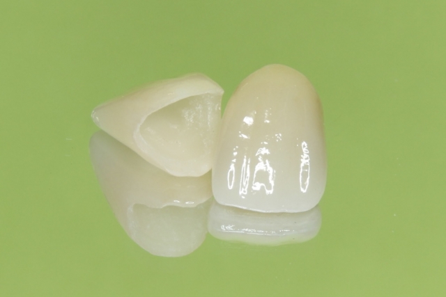 セラミッククラウンの見本