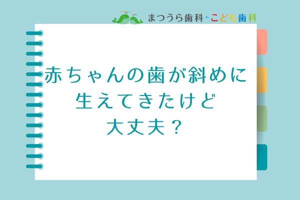 赤ちゃんの歯が斜めに生えてきたけど大丈夫？アイキャッチ画像