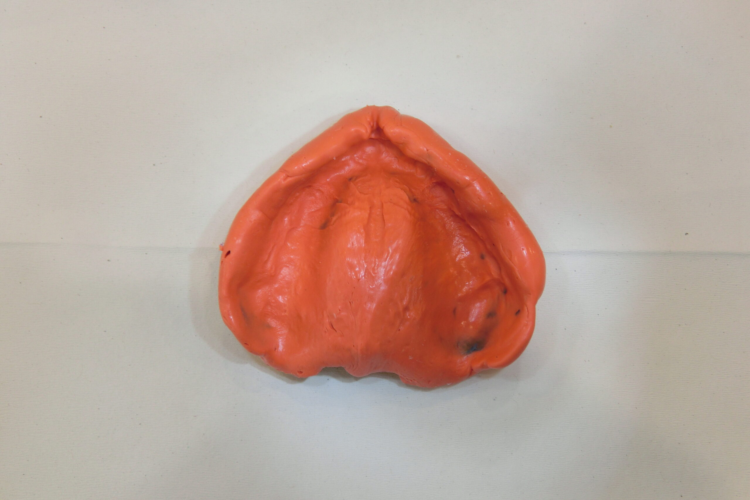 咬合床付きトレーを用いた上顎の精密機能印象