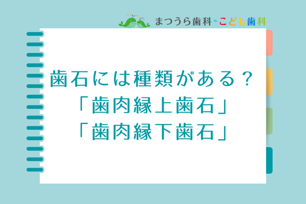 歯石には種類がある?歯肉縁上歯石と歯肉縁下歯石アイキャッチ画像