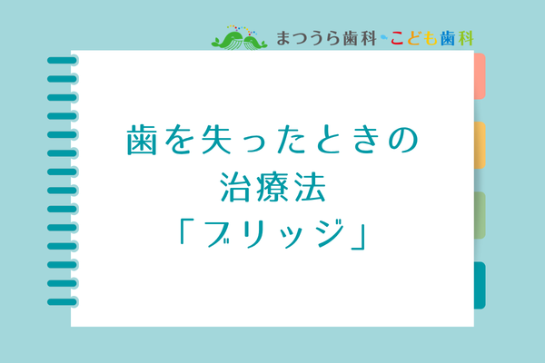歯を失ったときの治療法の「ブリッジ」アイキャッチ画像