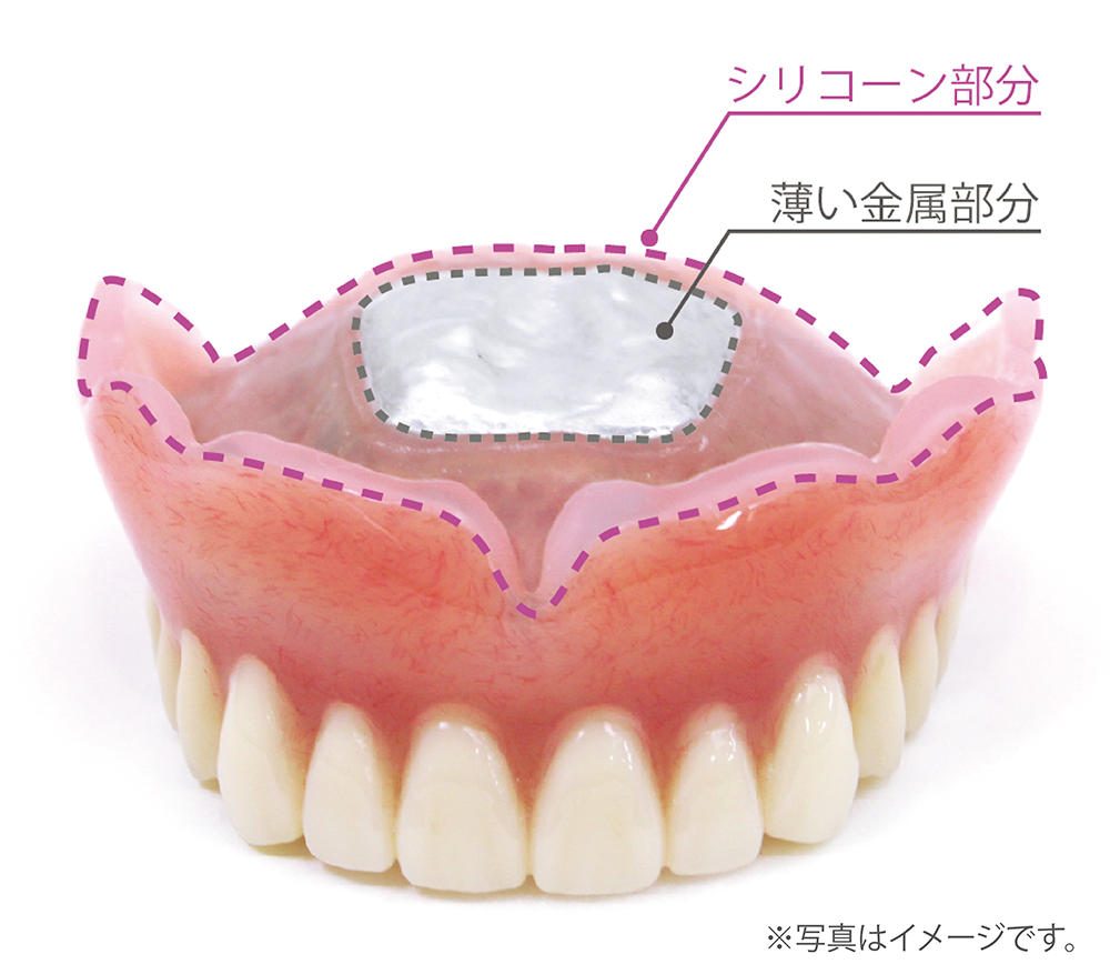 金属付きのシリコン入れ歯