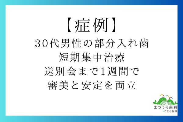 30代男性の部分入れ歯短期集中治療｜送別会まで1週間で審美と安定を両立