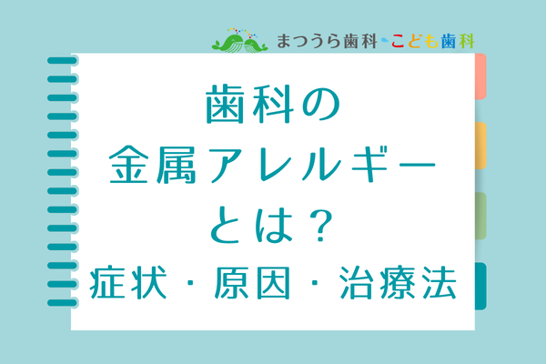 歯科の金属アレルギーとは？症状・原因・治療法アイキャッチ画像