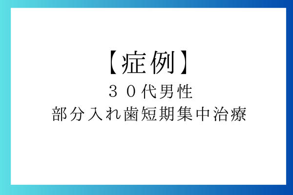 ３０代男性　部分入れ歯短期集中治療