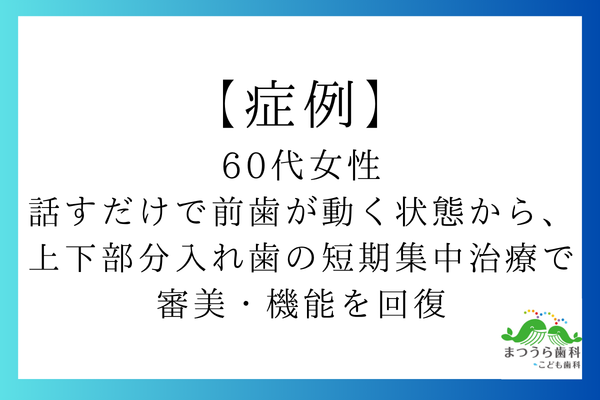 【症例】60代女性｜話すだけで前歯が動く状態から、上下部分入れ歯の短期集中治療で審美・機能を回復アイキャッチ画像