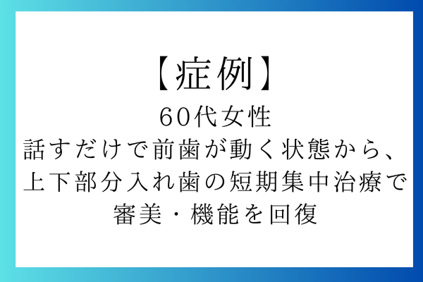 【症例】 60代女性 話すだけで前歯が動く状態から、 上下部分入れ歯の短期集中治療で 審美・機能を回復のアイキャッチ画像