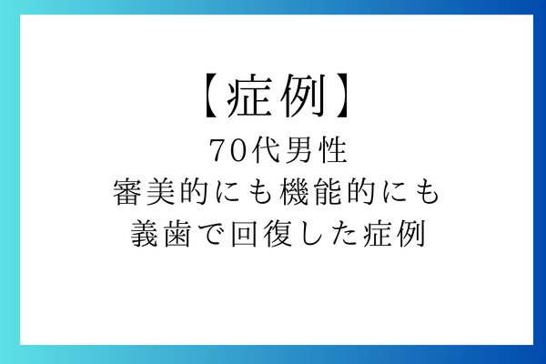 70代男性　審美的にも機能的にも義歯で回復した症例
