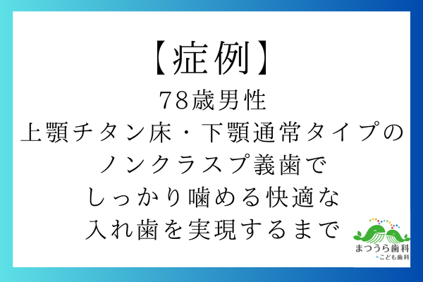 【症例紹介】78歳男性｜「入れ歯が壊れた」「下の歯の見た目を良くしたい」というご相談から、上顎チタン床・下顎通常タイプのノンクラスプ義歯でしっかり噛める快適な入れ歯を実現するまで