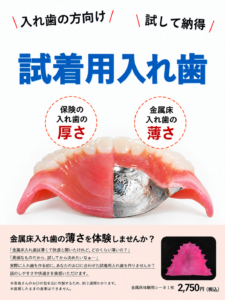 試着用入れ歯　金属床入れ歯の薄さの体験