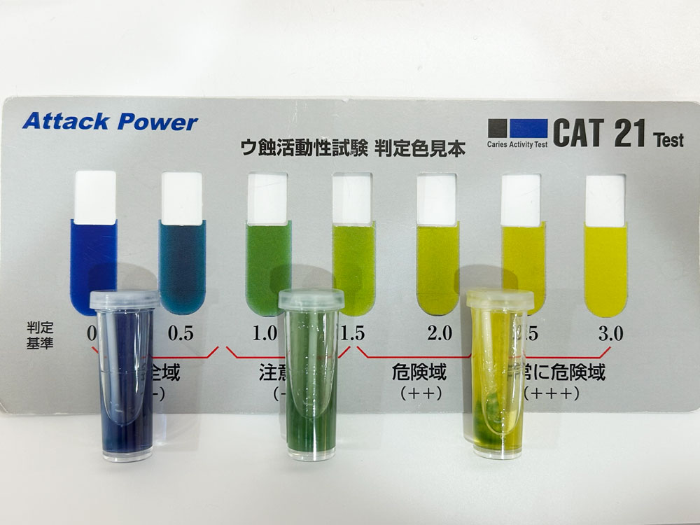 う蝕活動性試験