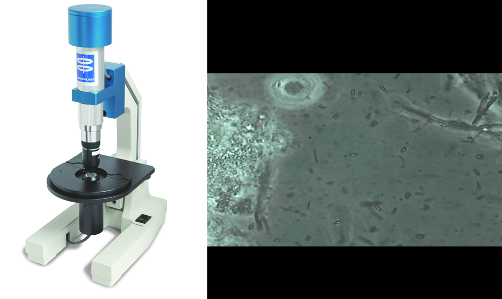 う蝕活動性試験